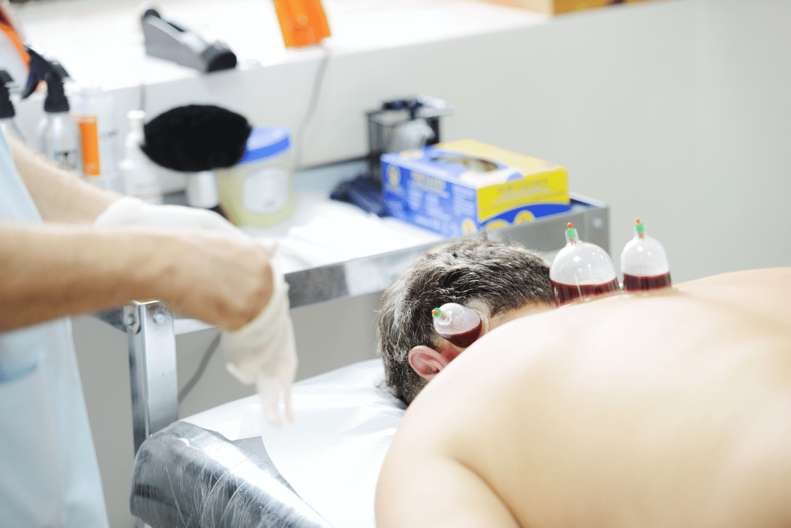 Hijama (Cupping Therapy)​