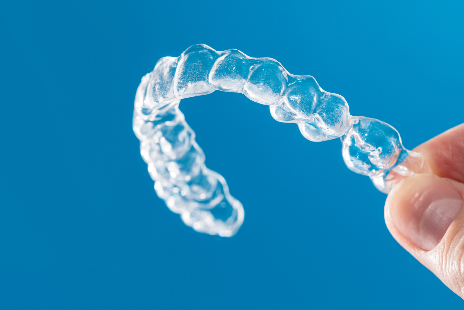 Braces vs. aligners