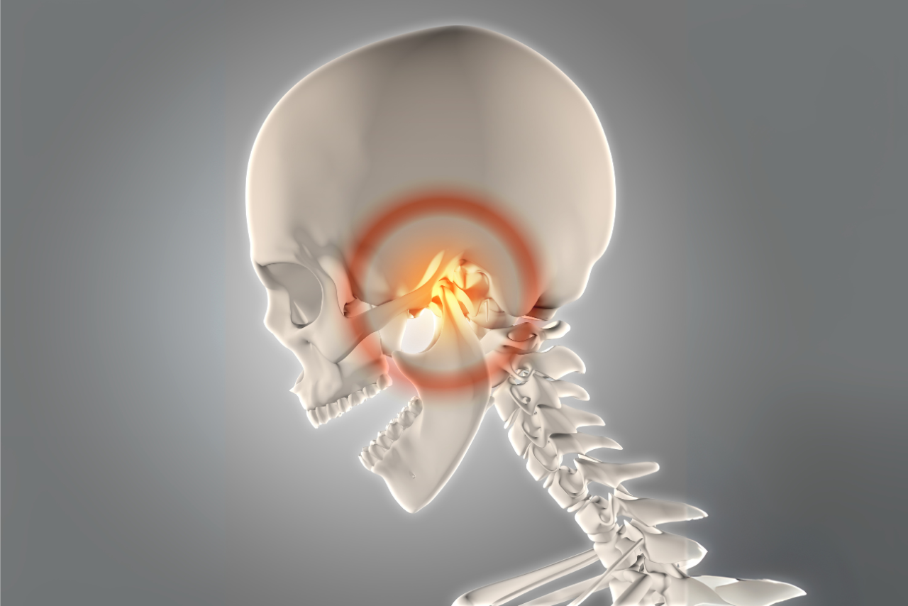 علاج مفصل الفك الصدغي (TMJ)