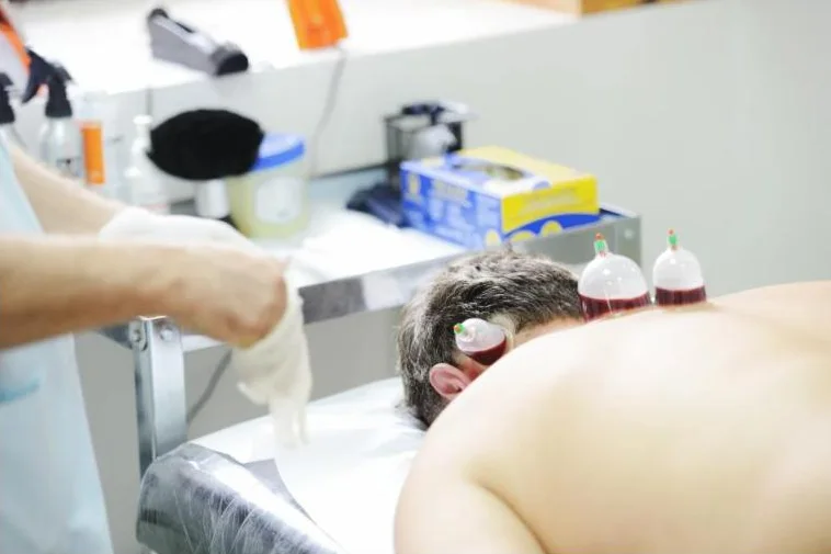 الحجامة (Hijama / Cupping Therapy)